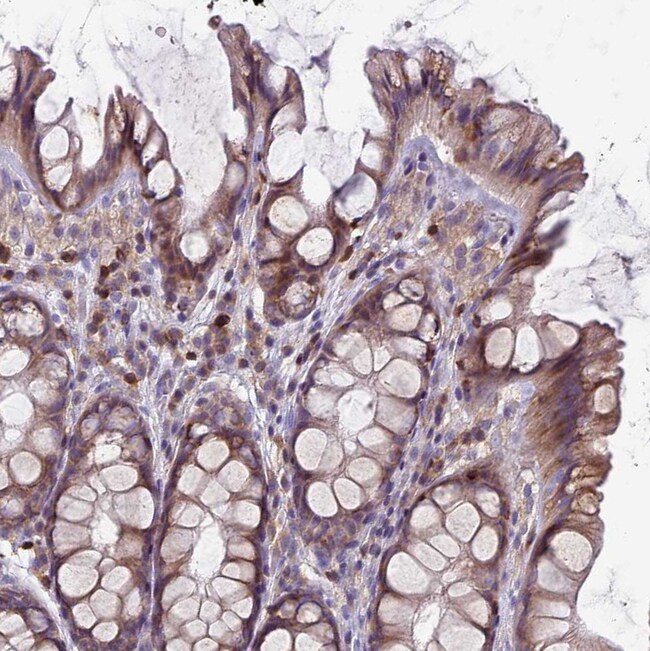 RAC1/RAC2/RAC3 Polyclonal Antibody