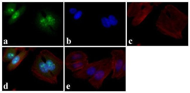 Phospho-p53 (Ser15) Recombinant Rabbit Monoclonal Antibody (14H61L24)