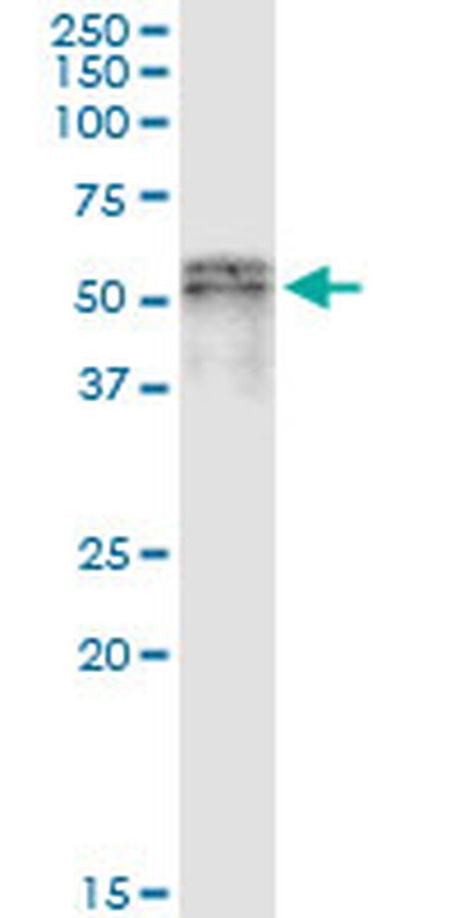 SCLY Monoclonal Antibody (3B2)