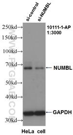 NUMBL Antibody in Western Blot (WB)