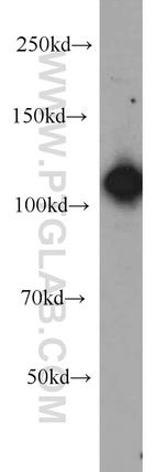 EFTUD2 Antibody in Western Blot (WB)