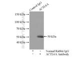 ACTL6A Antibody in Immunoprecipitation (IP)