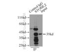STOML2 Antibody in Immunoprecipitation (IP)