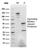 Tubulin beta 3/TUBB3 Antibody in SDS-PAGE (SDS-PAGE)