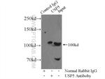 USP5 Antibody in Immunoprecipitation (IP)