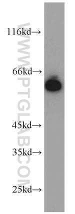 GORASP2 Antibody in Western Blot (WB)