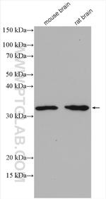 DARPP32 Antibody in Western Blot (WB)