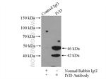 IVD Antibody in Immunoprecipitation (IP)