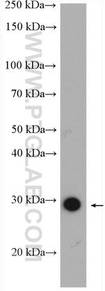 ANP32B Antibody in Western Blot (WB)