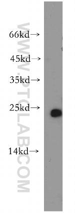 GLTP Antibody in Western Blot (WB)