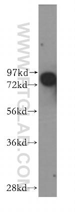 CNKSR1 Antibody in Western Blot (WB)