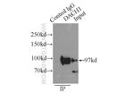 DACH1 Antibody in Immunoprecipitation (IP)