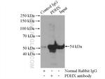 PDHX Antibody in Immunoprecipitation (IP)
