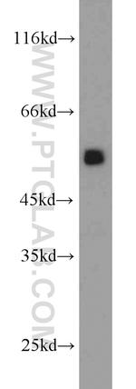 PDHX Antibody in Western Blot (WB)