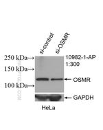 OSMR Antibody in Western Blot (WB)