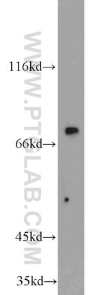 MIPEP Antibody in Western Blot (WB)