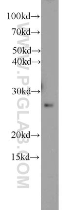 RAB33A Antibody in Western Blot (WB)
