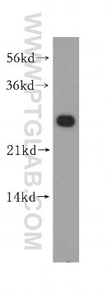 MMAB Antibody in Western Blot (WB)