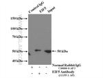 EIF5 Antibody in Western Blot (WB)