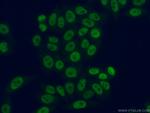 HNRNPA1 Antibody in Immunocytochemistry (ICC/IF)