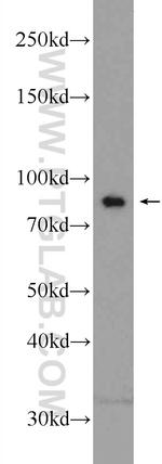MCM7 Antibody in Western Blot (WB)