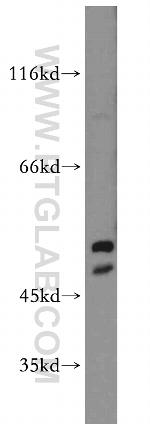 HARS2 Antibody in Western Blot (WB)