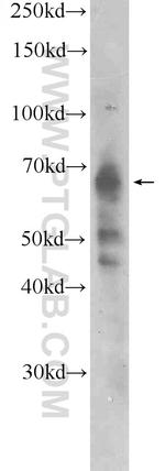 EYA2 Antibody in Western Blot (WB)