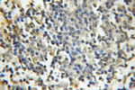DDX1 Antibody in Immunohistochemistry (Paraffin) (IHC (P))