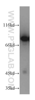 DDX1 Antibody in Western Blot (WB)