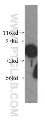 DDX1 Antibody in Western Blot (WB)