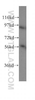 RAD23A Antibody in Western Blot (WB)