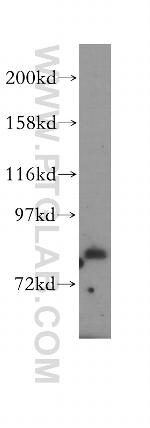 HPS6 Antibody in Western Blot (WB)