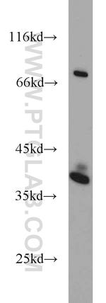 SPRY2 Antibody in Western Blot (WB)