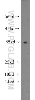 NMNAT1 Antibody in Western Blot (WB)