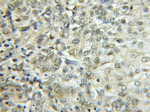 EHD2 Antibody in Immunohistochemistry (Paraffin) (IHC (P))