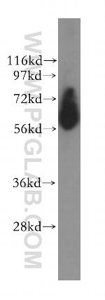 EHD2 Antibody in Western Blot (WB)