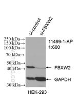 FBXW2 Antibody in Western Blot (WB)