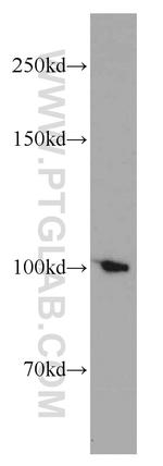 TPX2 Antibody in Western Blot (WB)