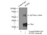 Surfactant protein D Antibody in Immunoprecipitation (IP)