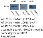AP3M2 Antibody in Western Blot (WB)