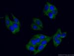 Gamma cystathionase Antibody in Immunocytochemistry (ICC/IF)