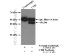 Gamma cystathionase Antibody in Immunoprecipitation (IP)