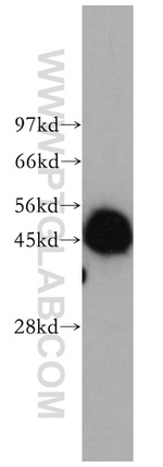 PSMD6 Antibody in Western Blot (WB)