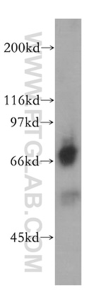 QSOX1 Antibody in Western Blot (WB)