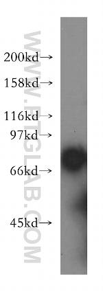 SLC20A2 Antibody in Western Blot (WB)