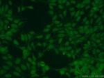 NUDT16 Antibody in Immunocytochemistry (ICC/IF)