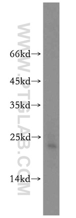 NUDT16 Antibody in Western Blot (WB)