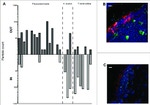 CD11c Antibody in Immunohistochemistry (IHC)