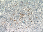 S100A7/Psoriasin Antibody in Immunohistochemistry (Paraffin) (IHC (P))