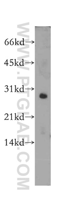 SNAI1 Antibody in Western Blot (WB)